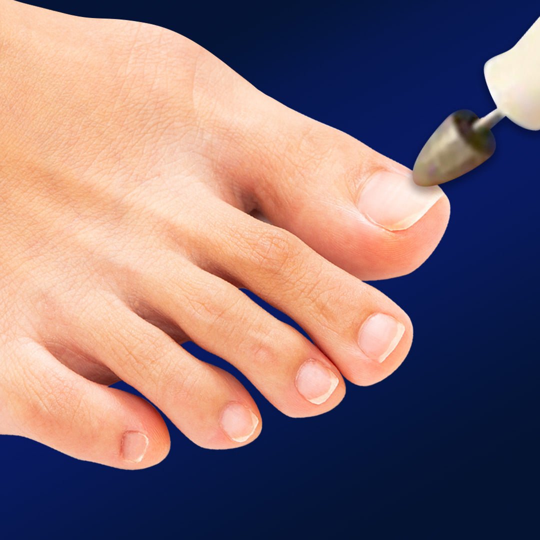 My Lovely Feet® - Medicool